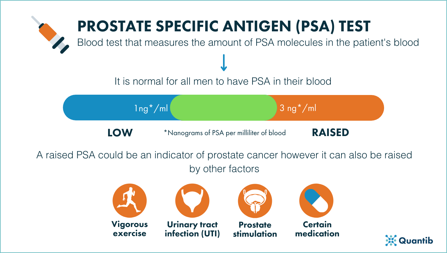 how-can-urologists-improve-patient-care-in-the-prostate-cancer-pathway